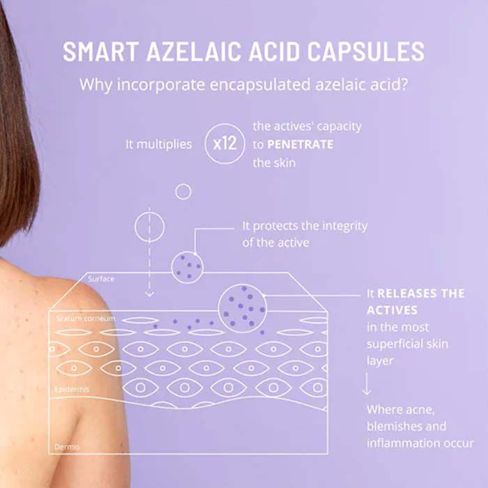 Azelaic Active Body Treatment  100ml-228964 3