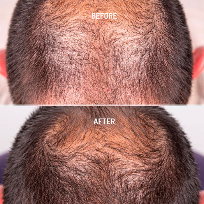 Hair Growth & Density Treatment  50ml-225316 5