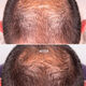 Hair Growth & Density Treatment  50ml-225316 5