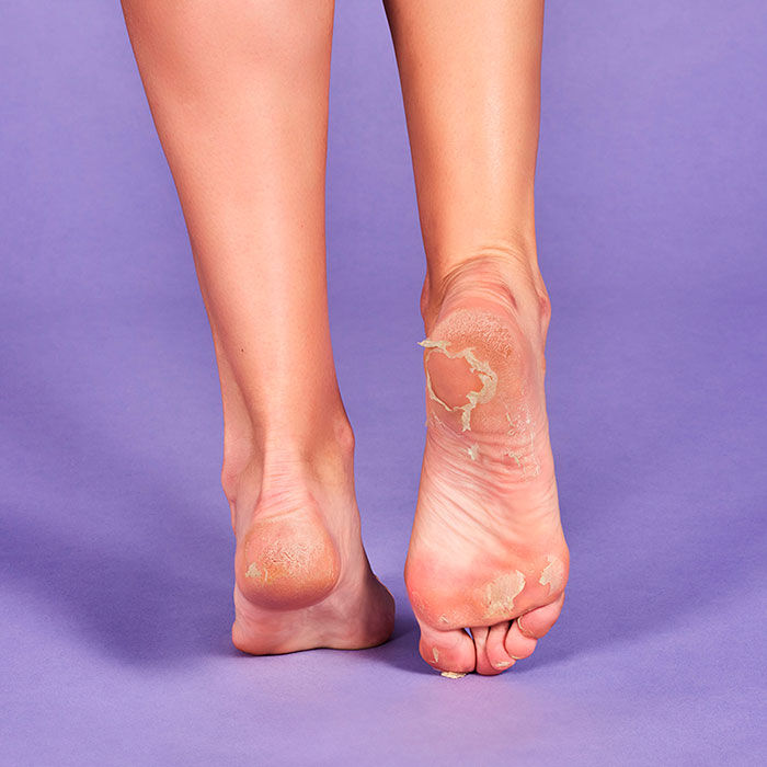 Calcetines Peeling y Exfoliantes  2ud.-204420 3