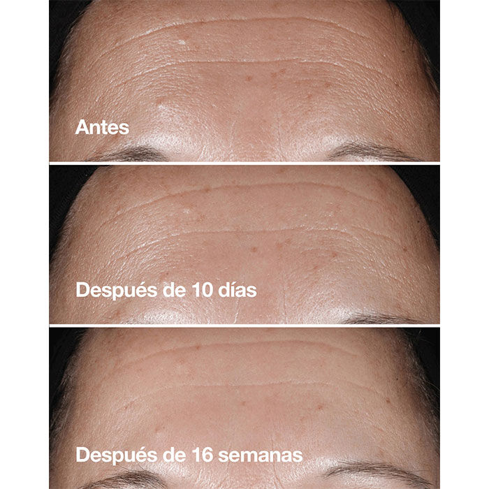 Clinique Smart Clinical Repair Wrinkle Correcting Serum  75ml-217716 5