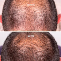Hair Growth & Density Treatment  50ml-214299 5