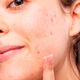 Azelaic Radiance Face Treatment  50ml-214267 3