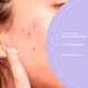 Azelaic Radiance Face Treatment  50ml-214267 4