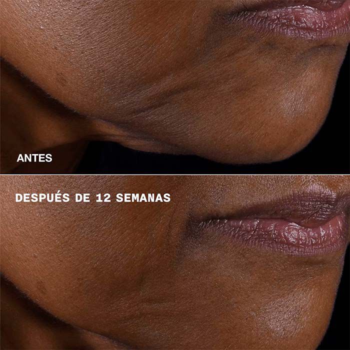 Clinique Smart Clinical Repair Lifting Face + Neck Cream  75ml-230761 5