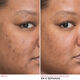 Bye Bye Dark Spots Concentrated Sérum  30ml-205827 3