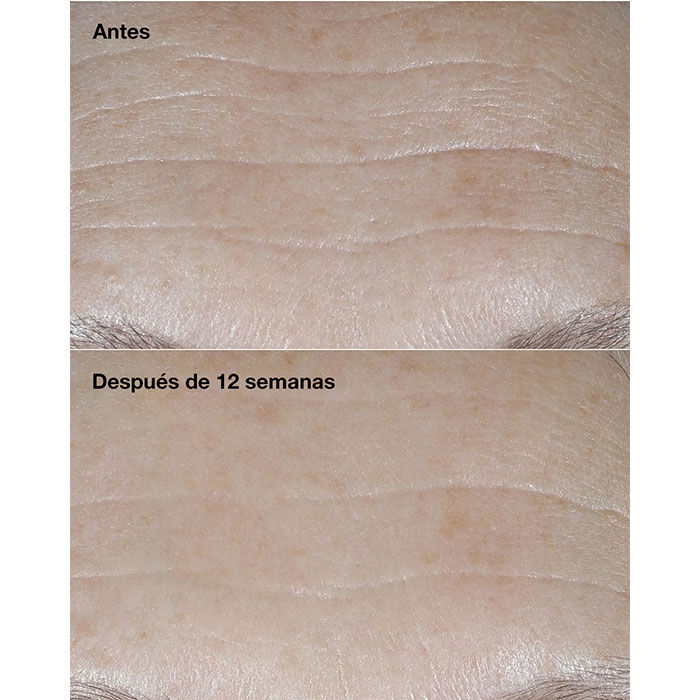 Clinique Smart Clinical Repair SPF30 Wrinkle Correcting Cream  50ml-217043 4