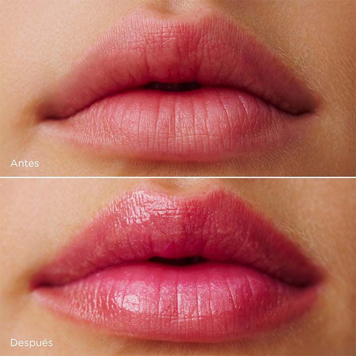 Lip Oil Balm Cryo   4