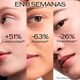 Ultimune Power Infusing Serum 4.0  50ml-227633 2