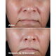 Clinique Smart Clinical Repair Rich Cream  50ml-207450 2