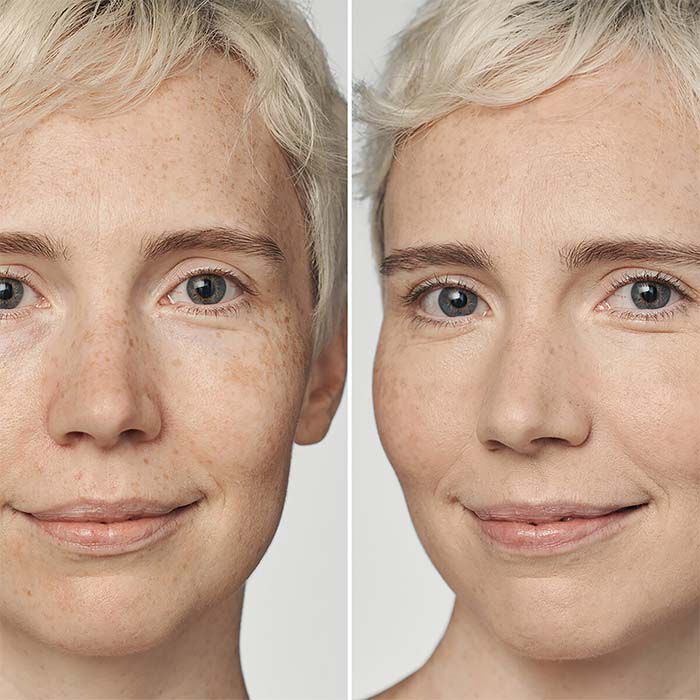 Even Better Clinical Serum Foundation SPF20   2