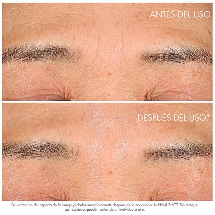 CAPTURE TOTALE HYALUSHOT  15ml-217555 3