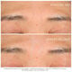 CAPTURE TOTALE HYALUSHOT  15ml-217555 3