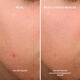 Bye Bye Breakout Sérum  30ml-212209 3