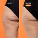Beta-Burner Sculpting Treatment  100ml-223374 1