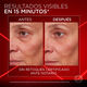 Revitalift Laser Borrador de Bolsas  15ml-235098 4