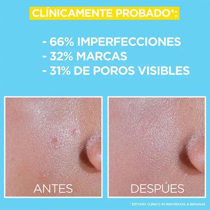 Pure Active Fluido Anti-Imperfecciones SPF50+  40ml-220271 3